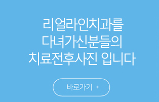전후사진
