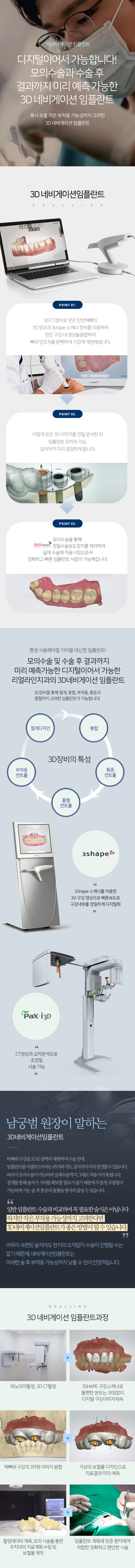 3D네비게이션 임플란트