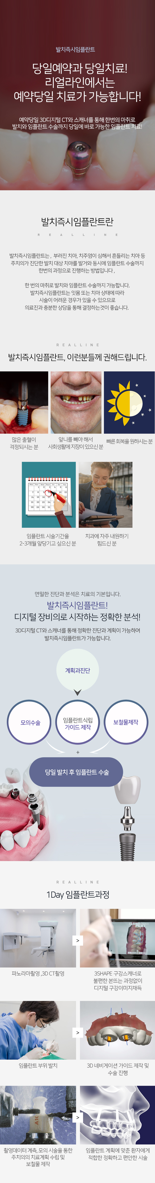 1Day임플란트
