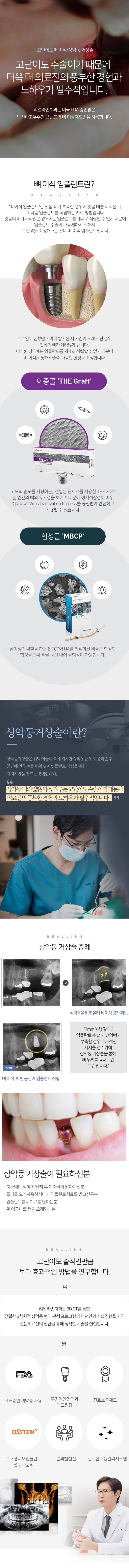 고난이도 뼈이식/상악동 거상술