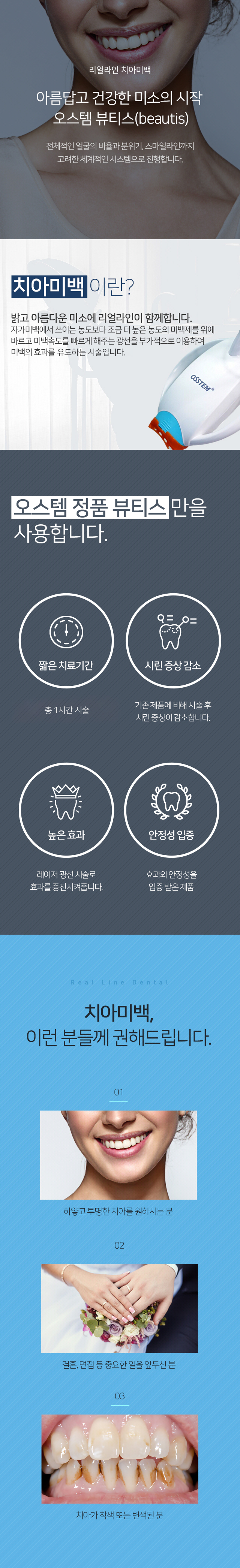 리얼라인 치아미백